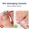 60PCS Nail Correction Patch Breathable Ingrown Toenail Sticker Nail Care Strips Customs Name: Plastic Patch