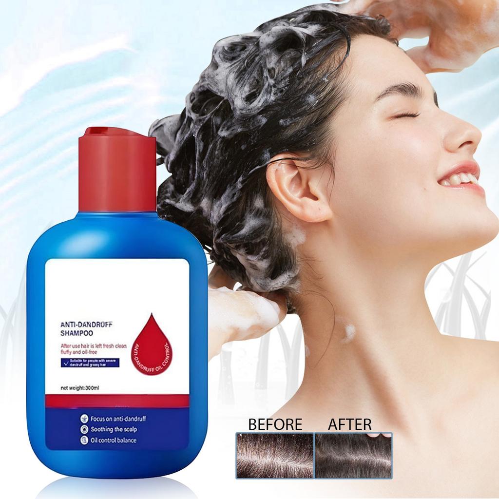 Шампунь, Шампунь с сульфидом селена, Шампунь для контроля жирности, уменьшает излишнюю жирность, мужской и женский, освежающий, 120 мл