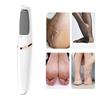 1 Set Electric Callus Remover Fast Charging Safer Foot Protection Professional Pedicure Tools Kit for Smooth Feet
