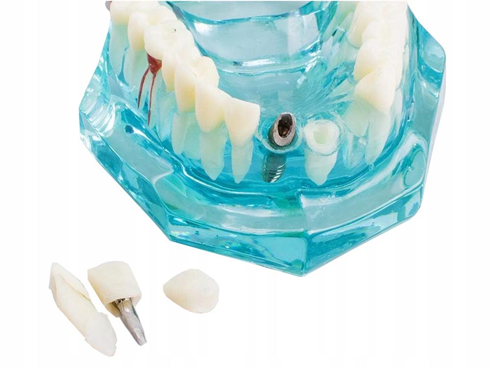 Dental Model 2 Blue (100) Gab_B