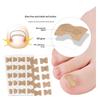 Foot Toenail Patch Correction Stickers Ingrown Correction Pedicure Tool Toe Inlay Nail Corrector Patch Paronychia Treatment