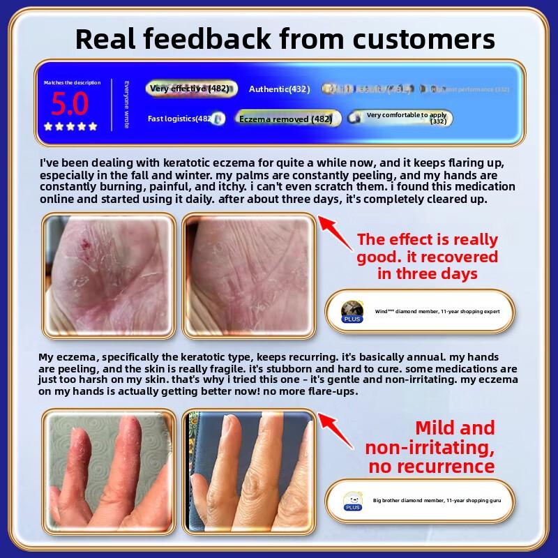 Полностью натуральный крем от дерматита - Успокаивает зудящую кожу, Мягкий для чувствительных типов, Облегчает экзему