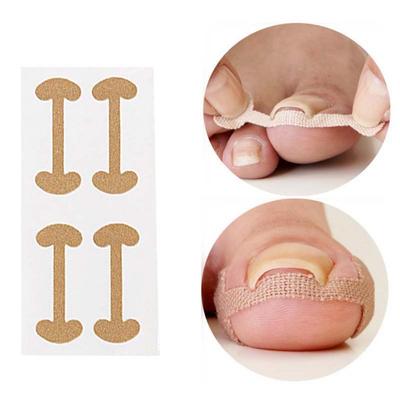 Корректор для ногтей для ухода за ногтями на ногах Лечение ногтей на ногах Наклейка Коррекция Восстановление Патч Вкладыши для ног