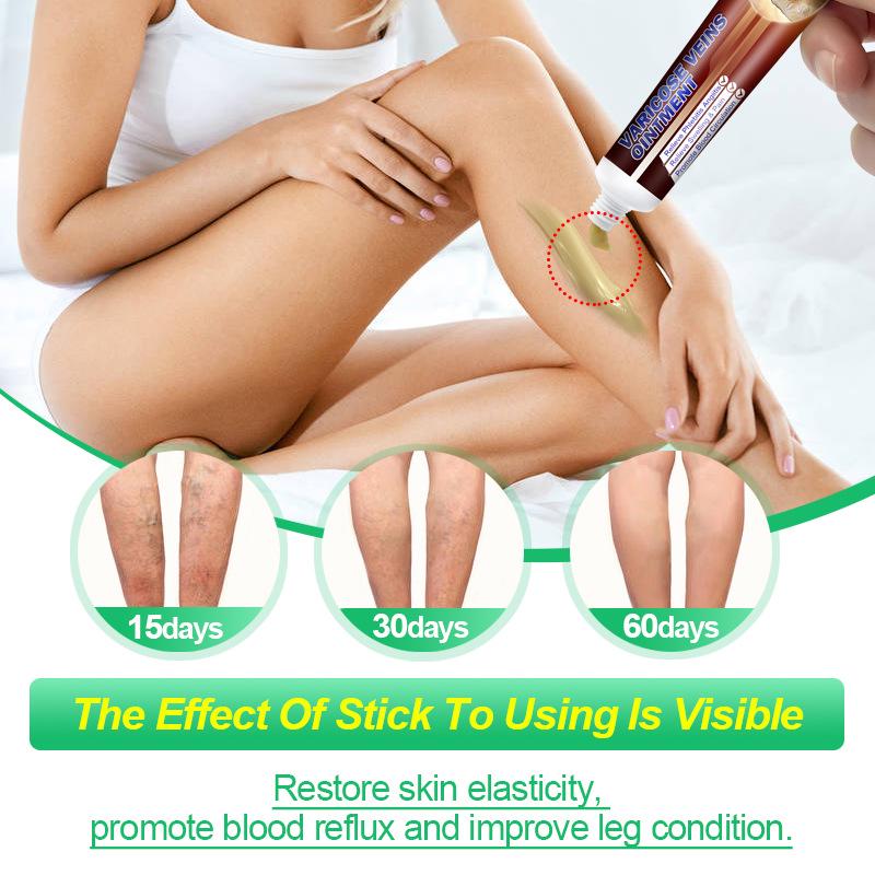 Крем Maikang Vein & Vasculitis от KanyeHB