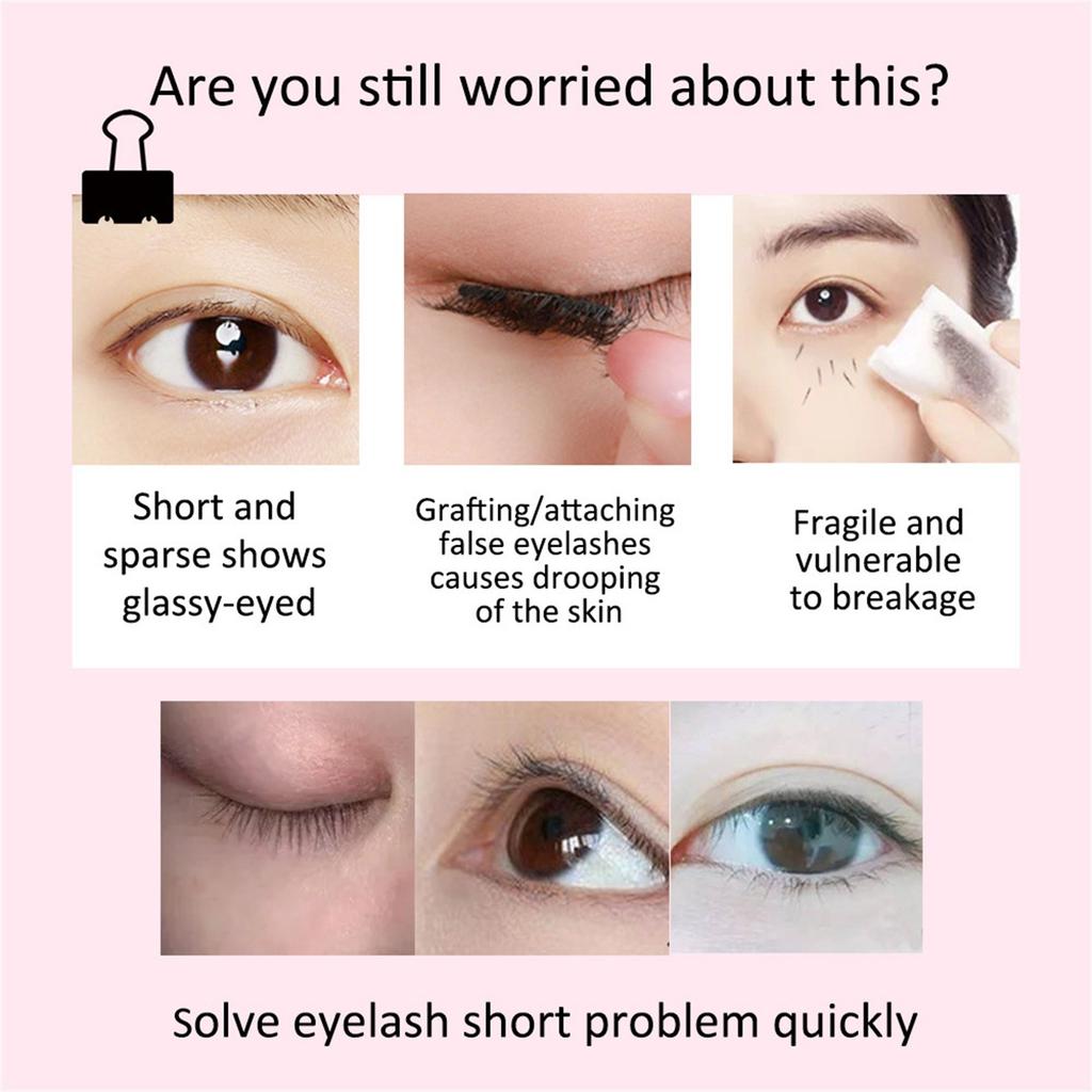 Eye Serum For Styes Chalazion And Blepharitis, Cleanses Lashes And Eyes,Healthier Eye Skin 20ml