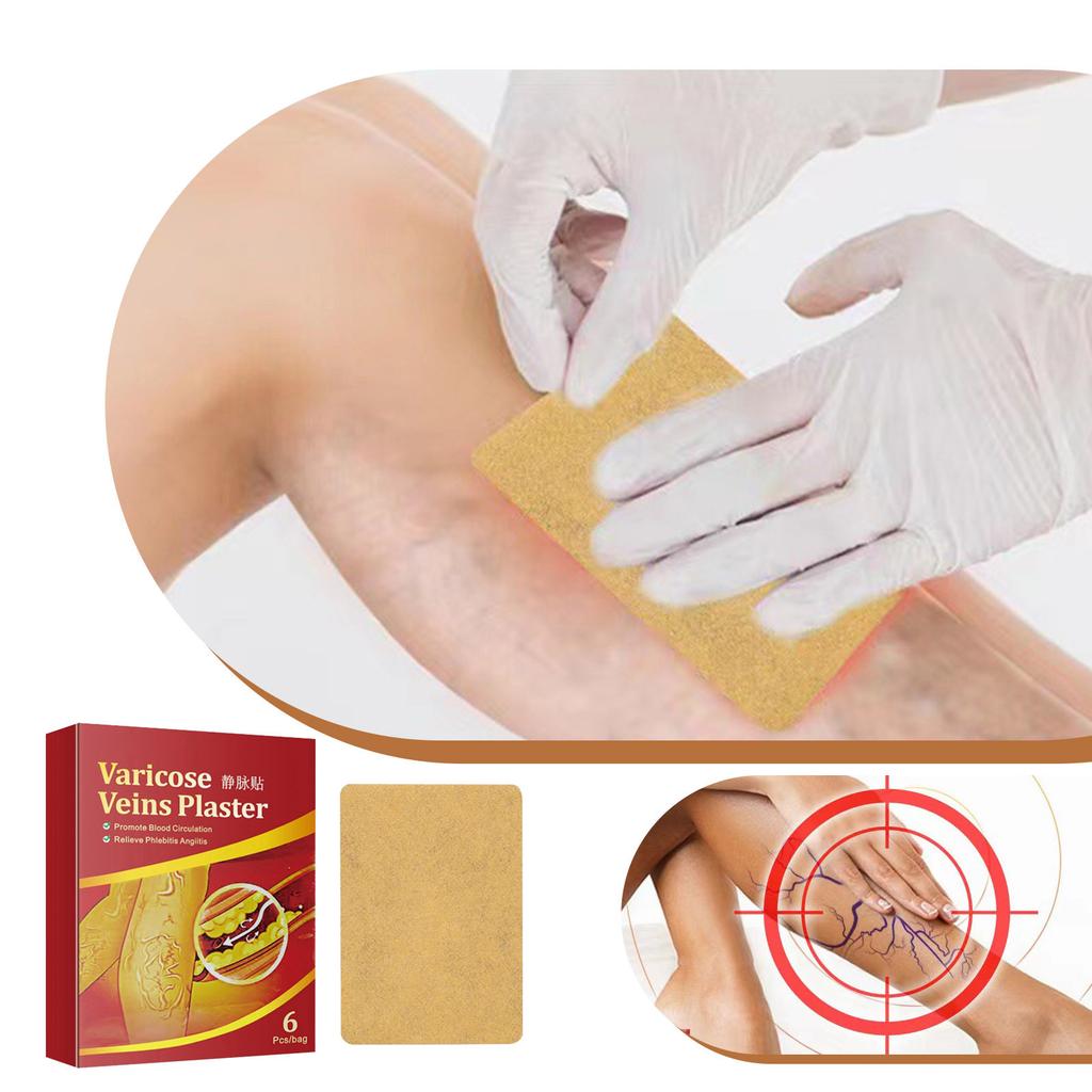 Пластырь от варикозного расширения вен, 6 шт., для улучшения циркуляции крови и предотвращения венозного тромбоза