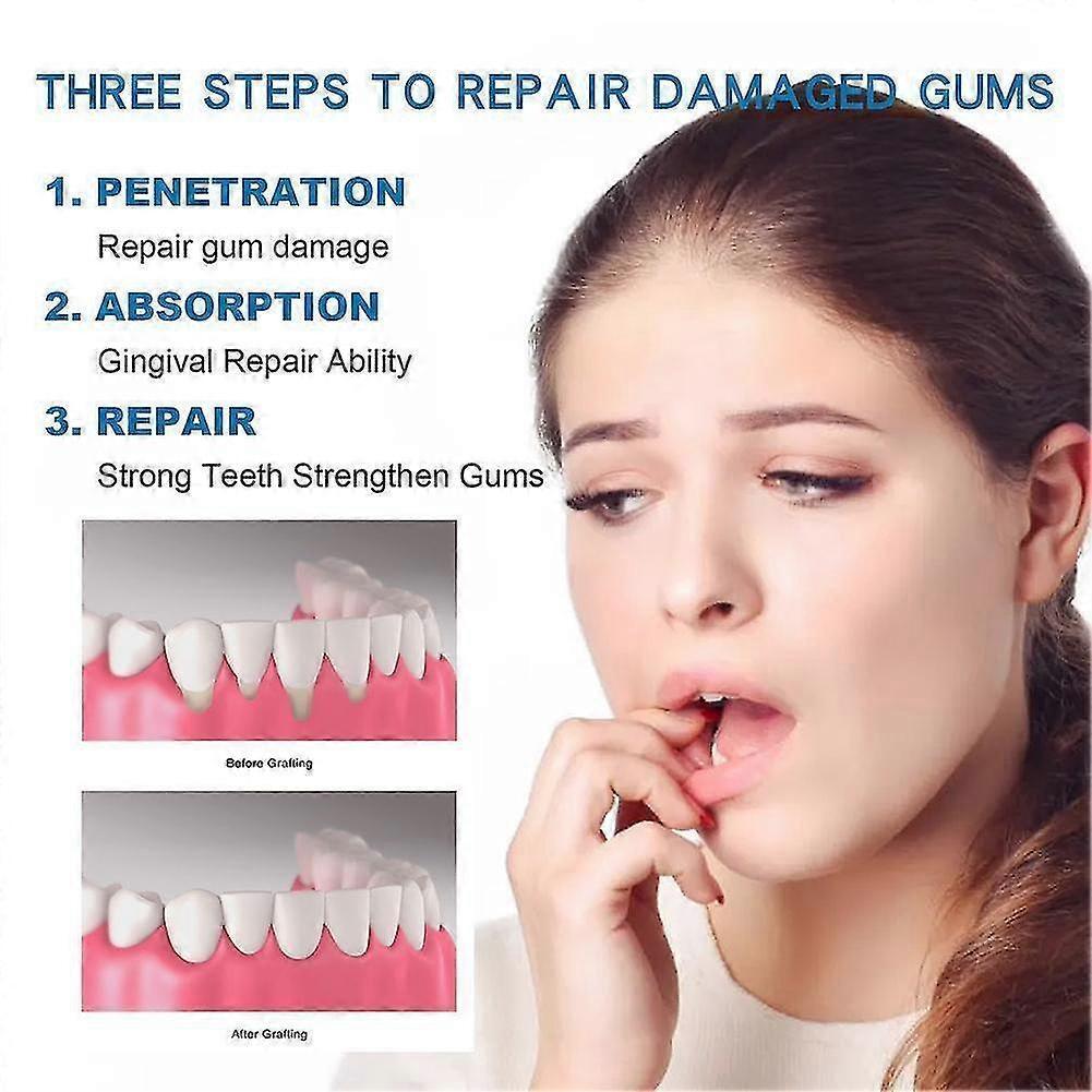 1-3X Gum Restore Plus - Oral Drops For Teeth, Bad Breath, Gums Repair 30ML