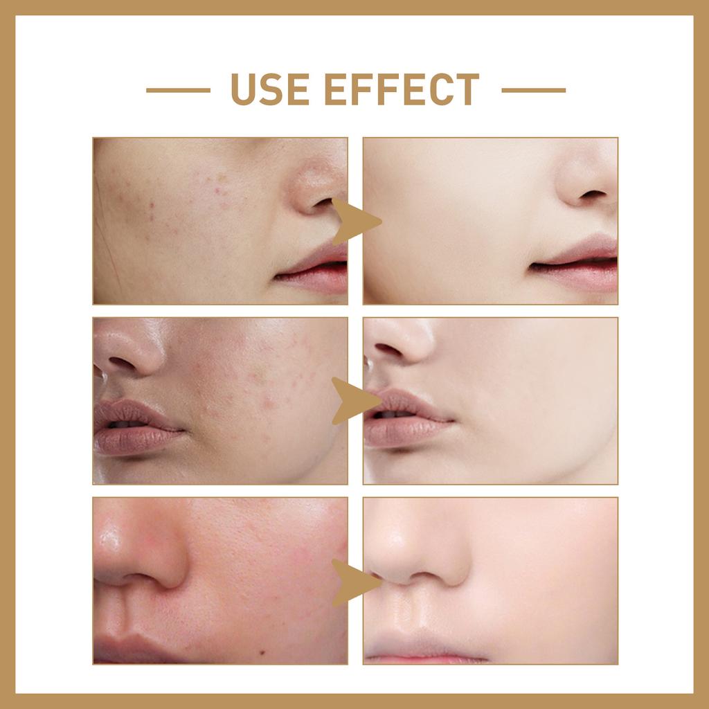 Тоник EELHOE Rice Toner для глубокого увлажнения, восстановления кожного барьера, укрепления и смягчения кожи лица