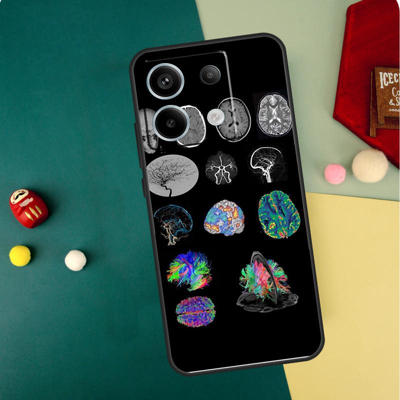 Чехол Anatomy Brain для Xiaomi Redmi Note 13 14 12 11 10 15 Pro Plus Redmi 13 15 14C 13C 15C 10C 12C Funda