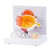 Human Eye Anatomy Model Anatomical Pathological Eyeball Model Teaching Tool Realistic Pathological Eyeball Anatomy Model