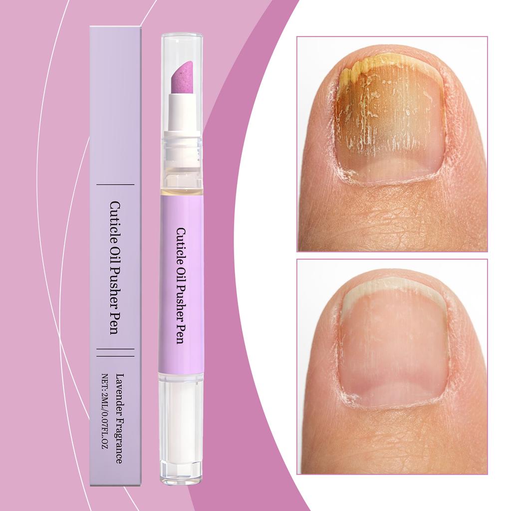 Nail Cuticle Oil Pen For Nourishing And Moisturizing The Nail Surface, Daily, Portable Nail Oil Pen For Application 2ml