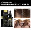 5% Minoxidil Hair Growth  For Men And Women - Infused With Biotin, Niacinamide And Panthenol