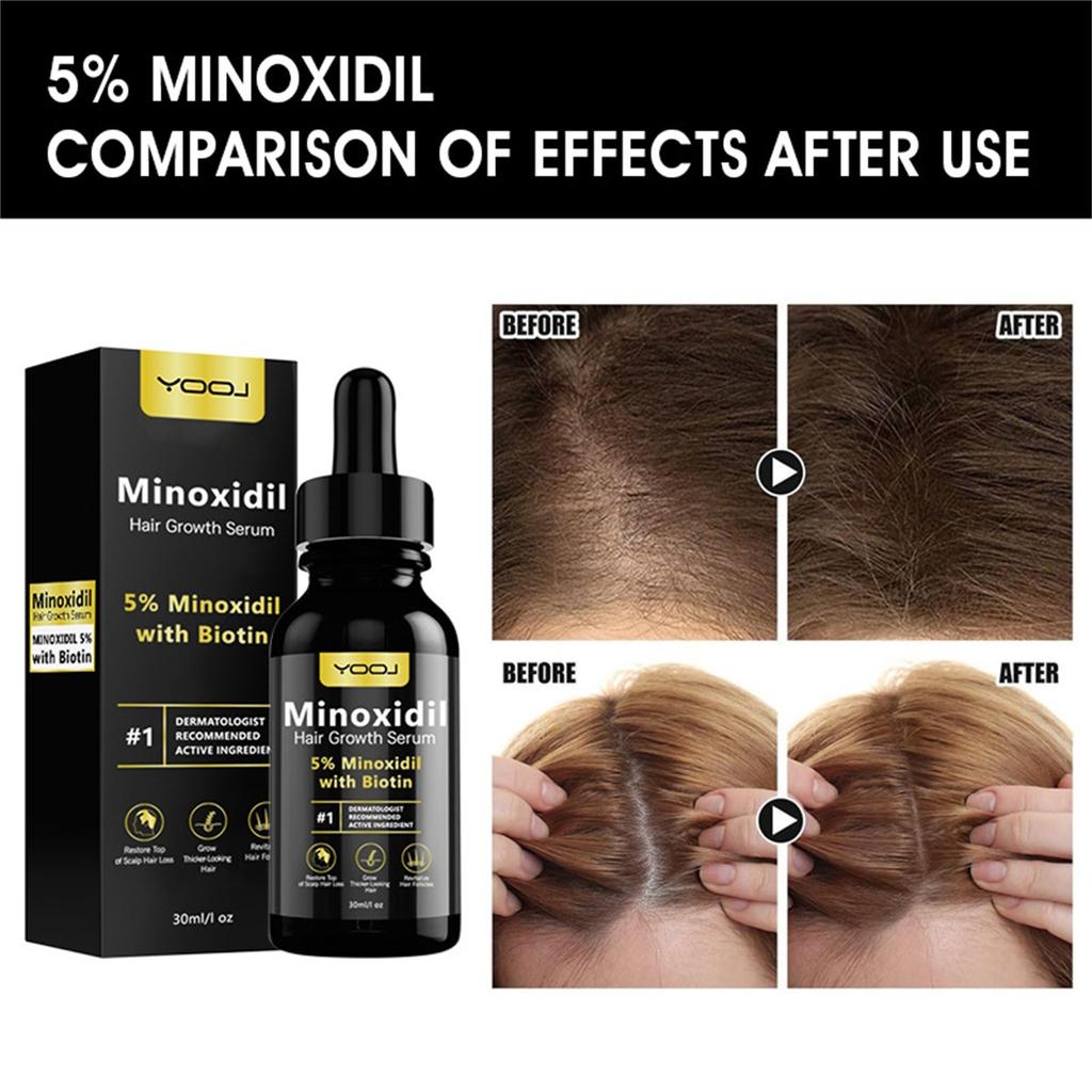 5% Minoxidil Hair Growth  For Men And Women - Infused With Biotin, Niacinamide And Panthenol