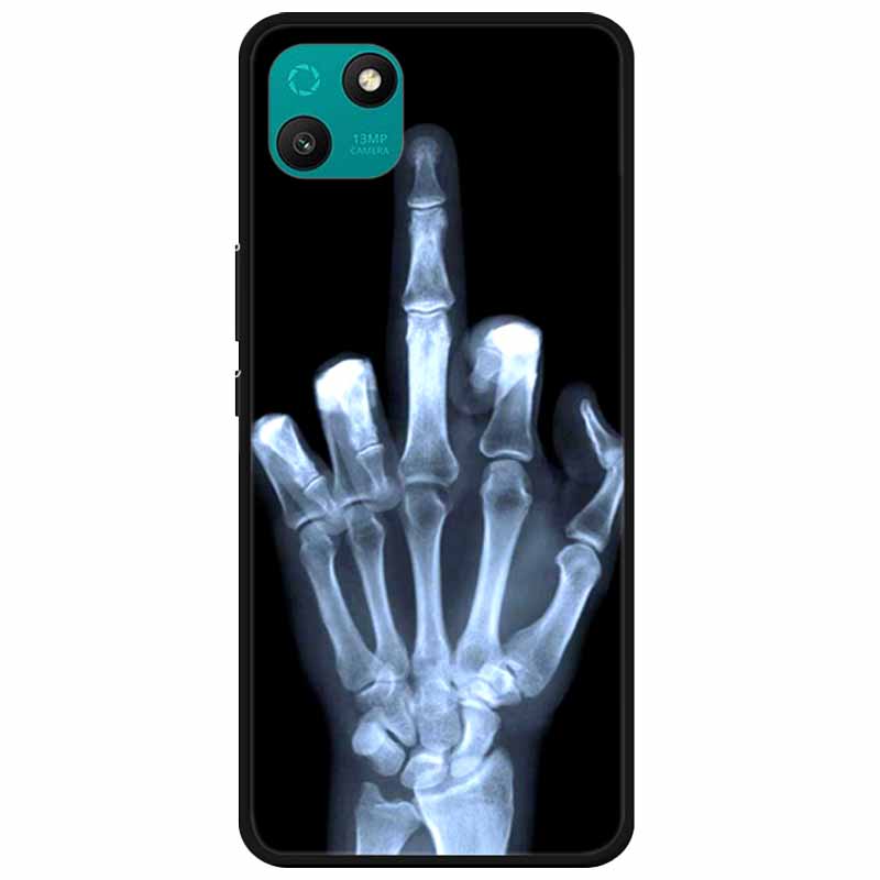 For Wiko T10 / T3 Case Soft Cartoon Cat TPU Silicone Phone Shells for WIKO T3 Bumper on for WikoT10 T 3 Fashion Protective Bags