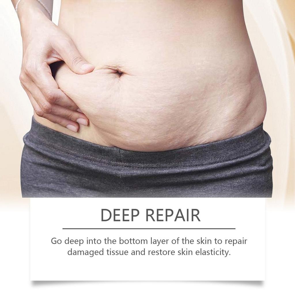 Beauty Removal Scar Премиум-комплексные масляные клетки, уменьшающие шрамы и прыщи, 100 мл