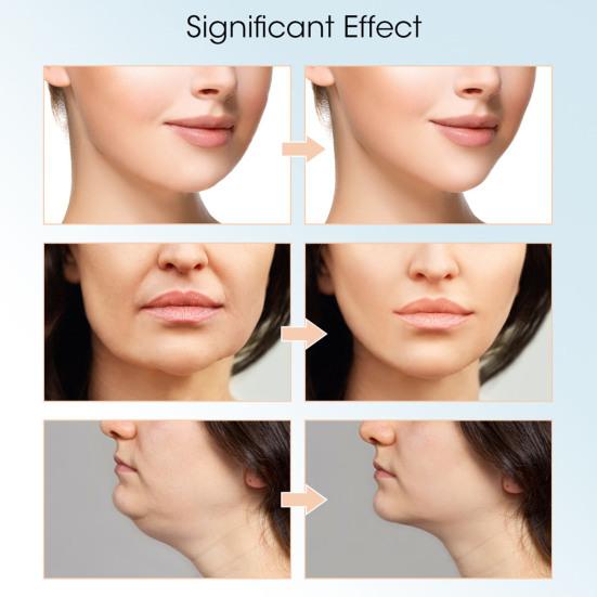 Электрический аппарат для подбородка V-образный прибор для похудения 8 режимов 15 уровней интенсивности перезаряжаемый массажер для лица покрытие подбородка косметический прибор для женщин