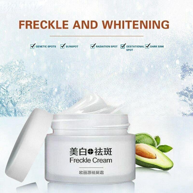 Отбеливающий крем от веснушек, увлажняющий крем для удаления веснушек, питательный уход за кожей