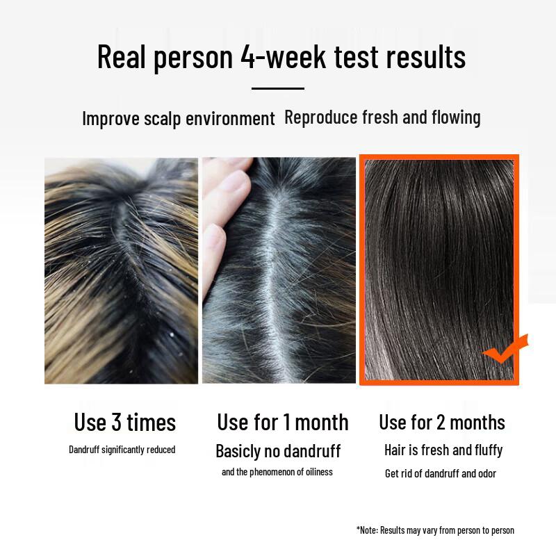 LK Amino Acid Anti-Dandruff Shampoo