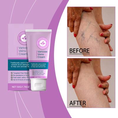 Уменьшите отек ног, дождевой червь, варикозное расширение вен, массаж вен, лосьон для ухода за телом