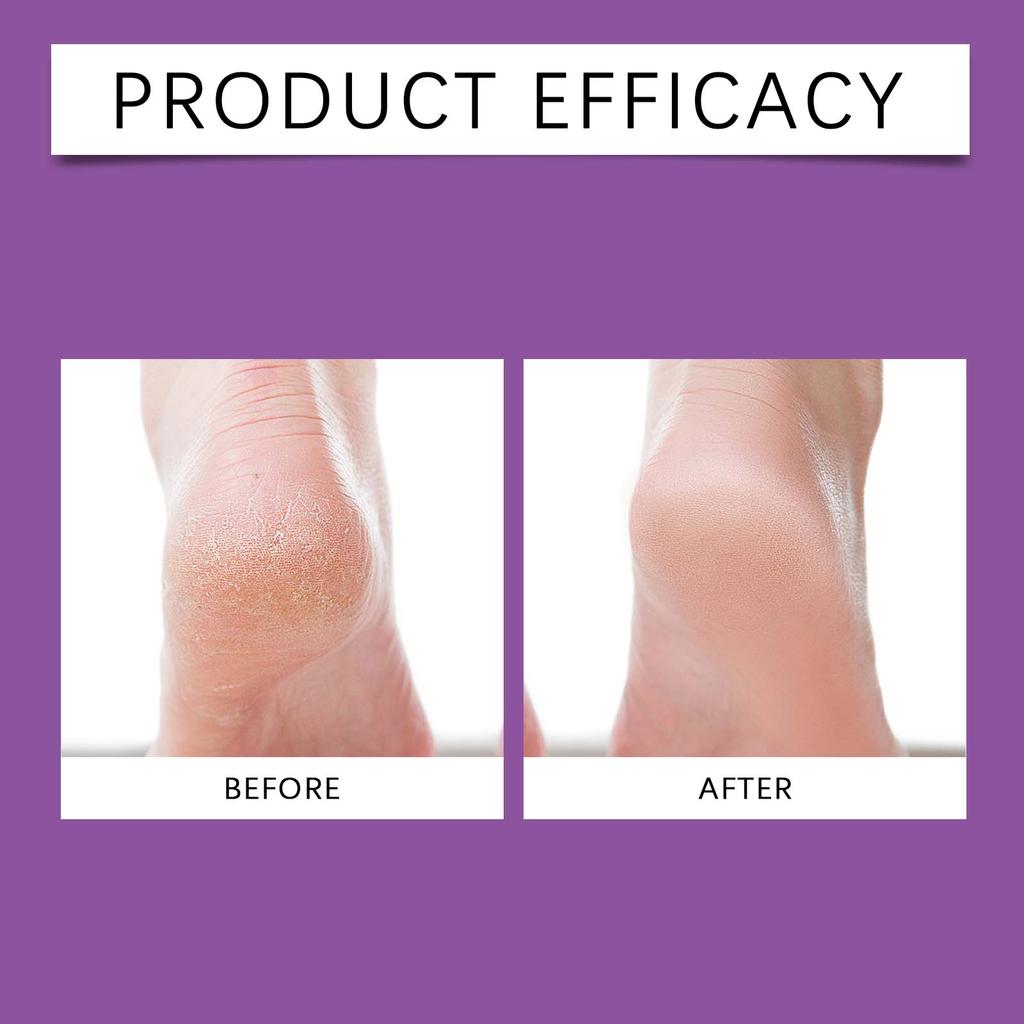 Лавандовая отшелушивающая маска для ног нежно ухаживает за ступнями. Он мягкий, гладкий и поставляется в индивидуальной упаковке для удобного использования. 5 мл