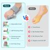 Adjustable Bunion Splint Big Toe Straightener Hallux Valgus Correction Orthotics Foot Bone Thumb Correction Bunions Corrector
