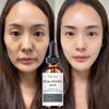 Средства по уходу за кожей Сыворотка для лица против старения Гиалуроновая кислота для лица Сужает поры Корейские средства по уходу за кожей