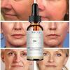 TCA Aid Skin Peel Трихлоруксусная кислота 20% Skin Peel Сокращение пор Морщины Пятна Уход за кожей Сыворотка для лица