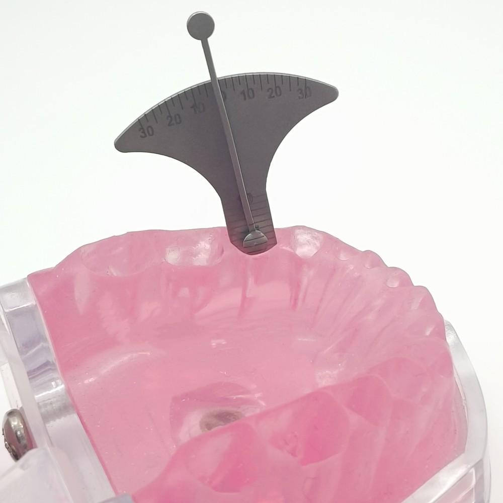 Набор инструментов для измерения высоты манжеты и аугуляции зубного имплантата. Стоматологическая измерительная линейка для измерения высоты разреза и угла наклона. Штангенциркуль.