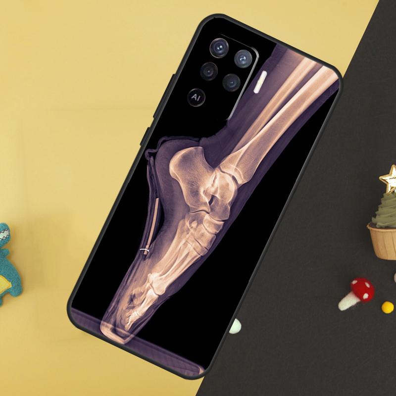 Чехол-кейс с рентгеновским изображением анатомии человека для Oppo A80 A60 A40 A54 A74 A94 A18 A38 A58 A78 A98 A96 A76 A16 A15 A17 A57 A5 A6 Pro