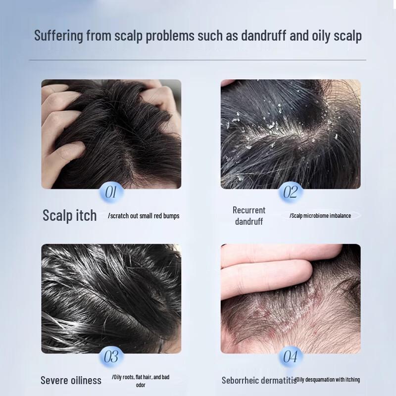 Шампунь против перхоти и зуда Nanjing Tong Ren Tang с дисульфидом селена 300 мл