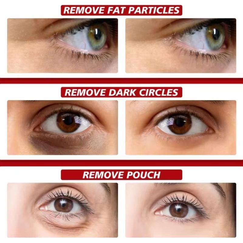 Крем для кожи вокруг глаз, удаляющий жировые гранулы, противовоспалительный, уменьшающий темные круги, разглаживающий мелкие морщины, восстанавливающий барьерный крем