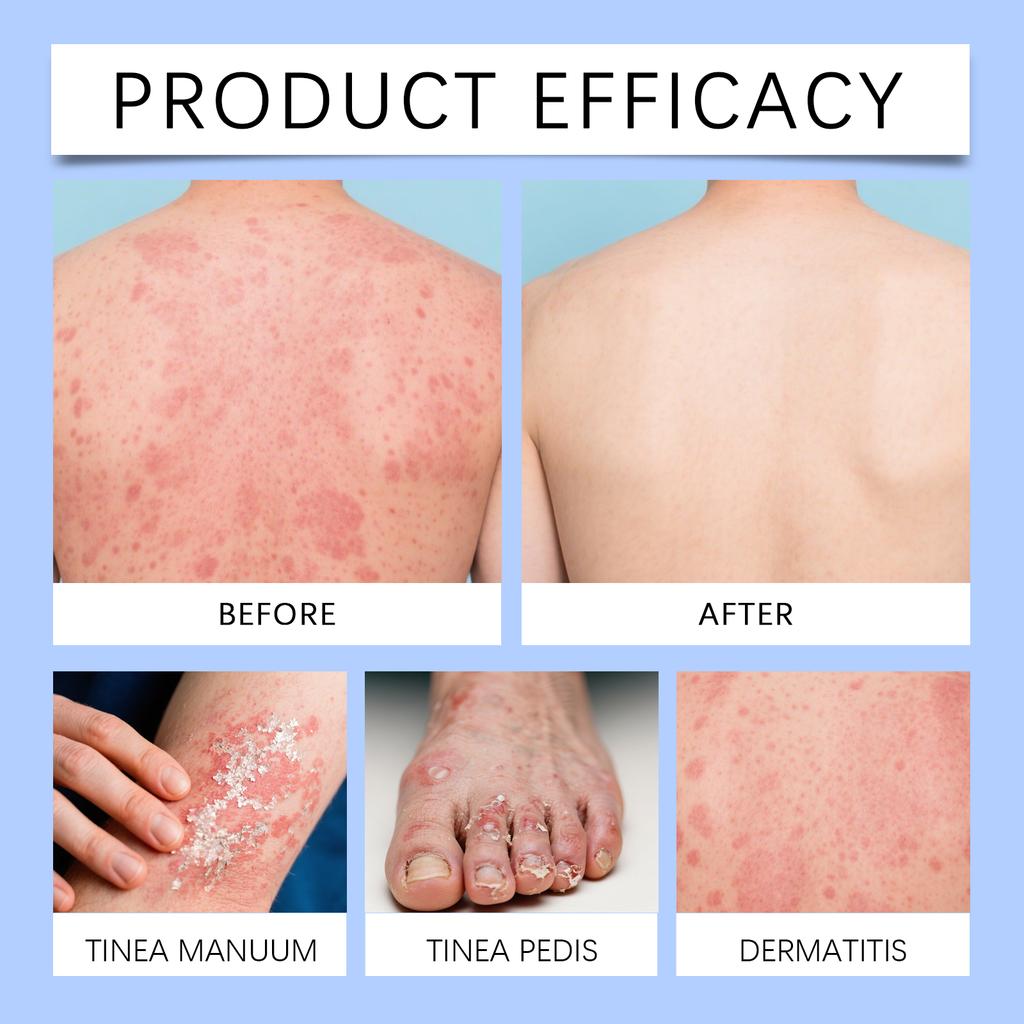 Магниевый травяной спрей, С мягкими ингредиентами, Питает тело и кожу. Это удобный ежедневный спрей для ухода за кожей, 50 мл