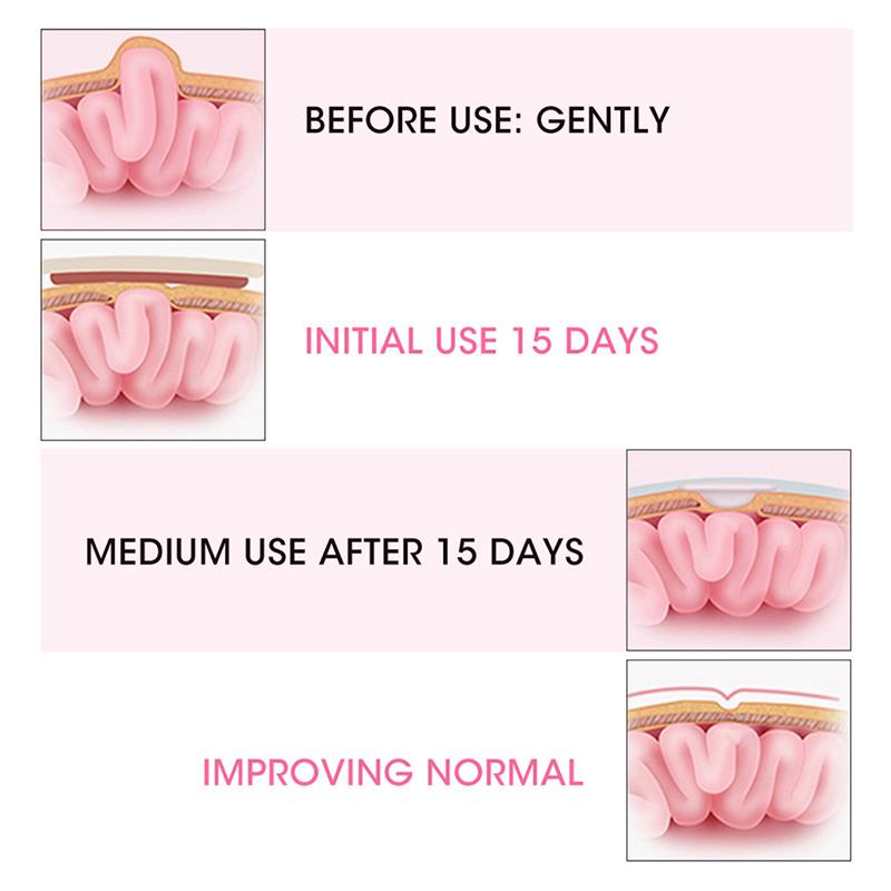 2 шт. пояс для лечения пупочной грыжи, дышащий эластичный хлопковый ремень для детей