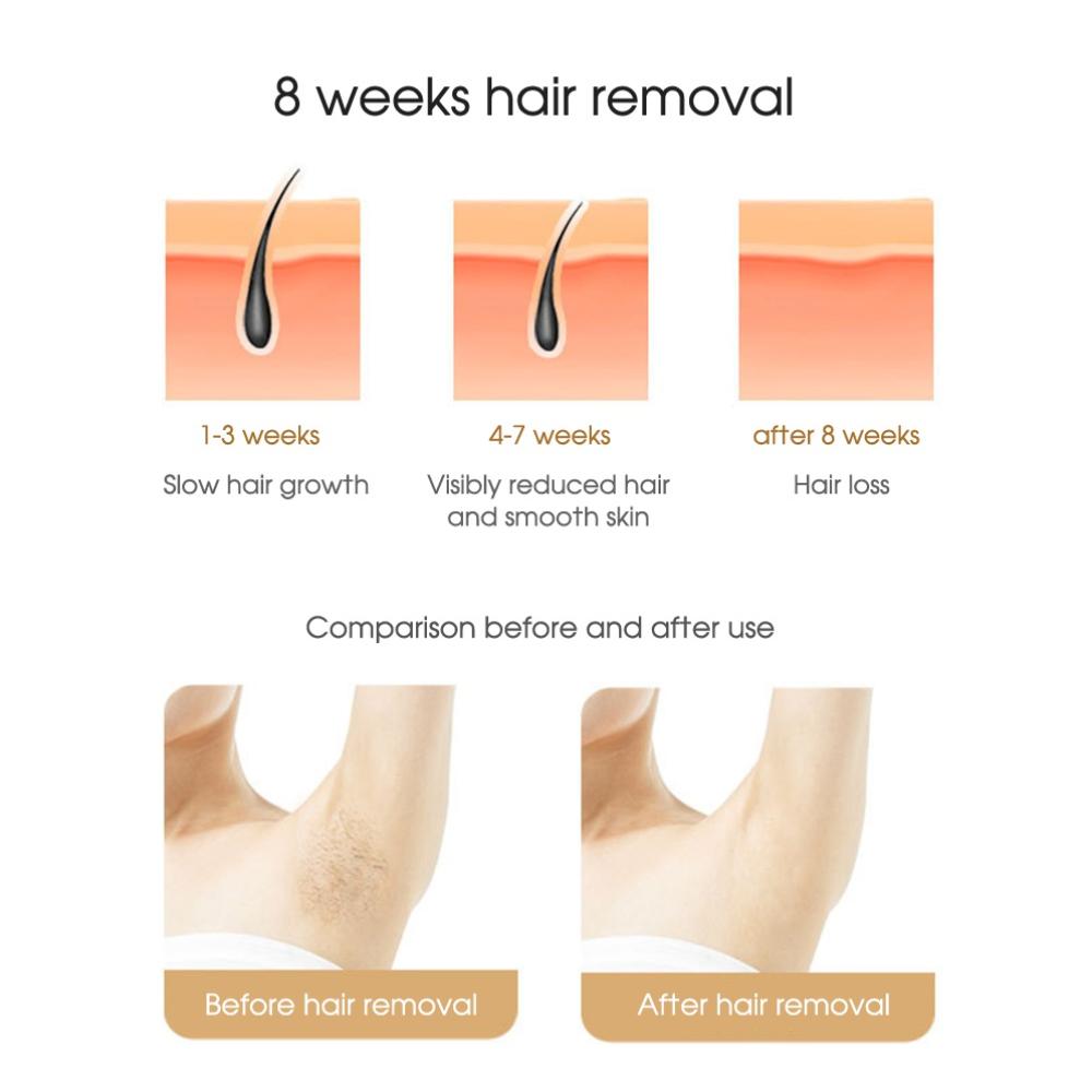 Body Bikini IPL 500 000 импульсов вспышки депилятор постоянный лазерный эпилятор безболезненный для женщин удаление волос устройства для домашнего использования