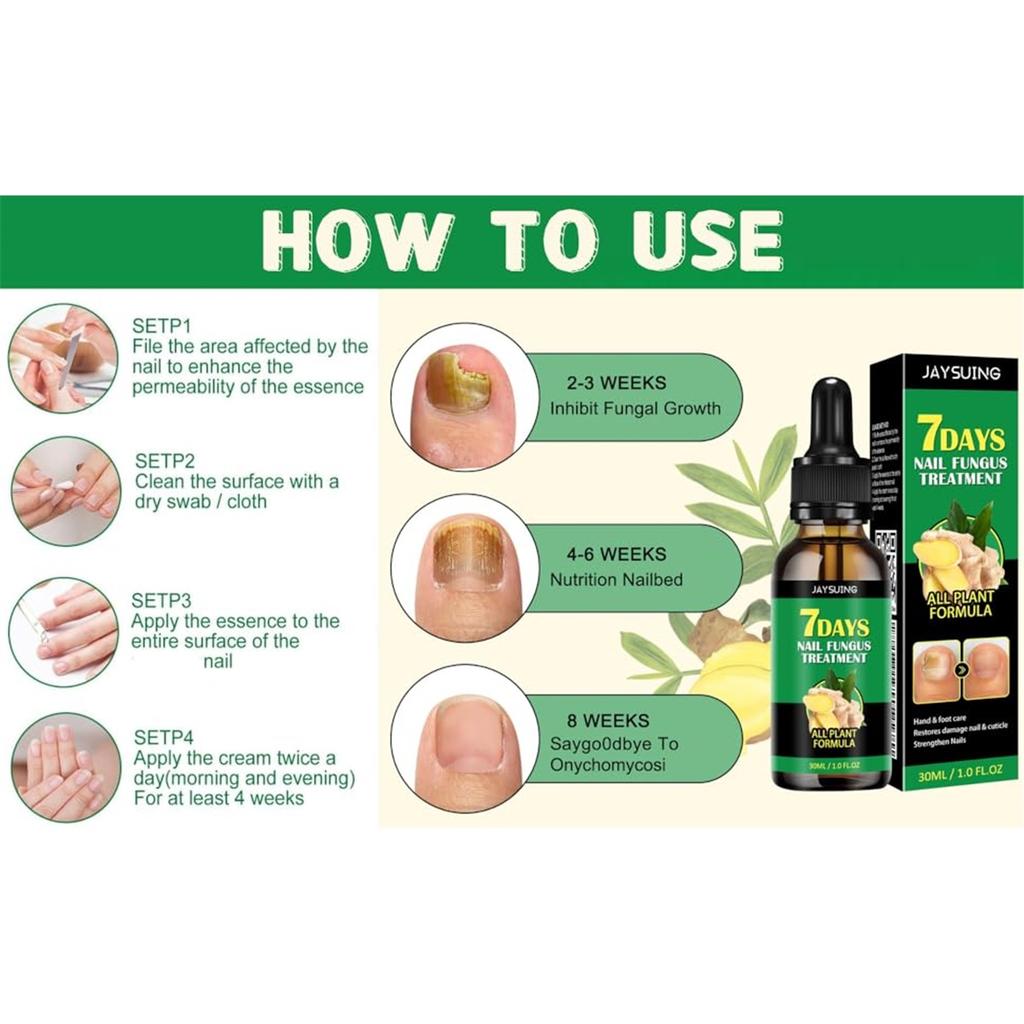 2PCS Ginger Growth Serum, Ginger Cuticula Care Oil for Nails, Ginger Nail Support