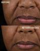 Strivectin Tl Peptight Lift Lifting Serum, 30