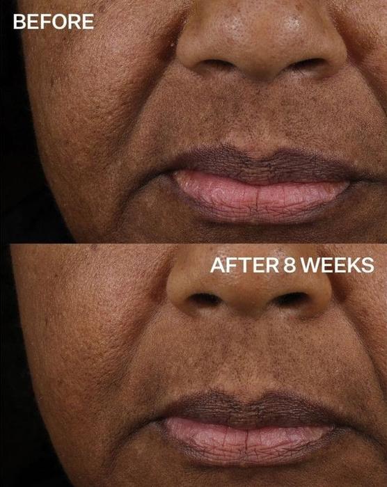 Strivectin Tl Peptight Lift Lifting Serum, 30