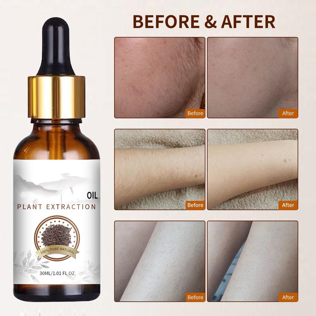 Масло для удаления волос Cyperus Rotundus Масло для удаления волос Cyperus Rotundus Растительное увлажняющее питательное масло для тела 30 мл