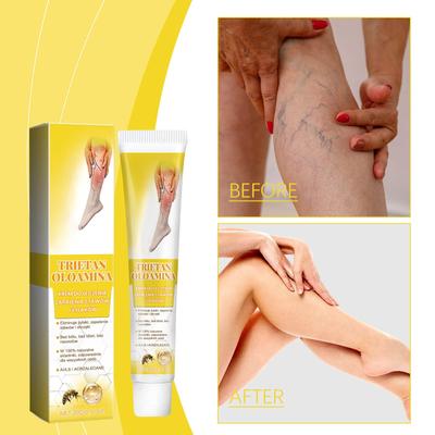 Крем от варикозного расширения вен, крем от варикозного расширения вен с пчелиным ароматом, крем от сосудистых звездочек, эффективно улучшает кровообращение и варикозное расширение вен на ногах