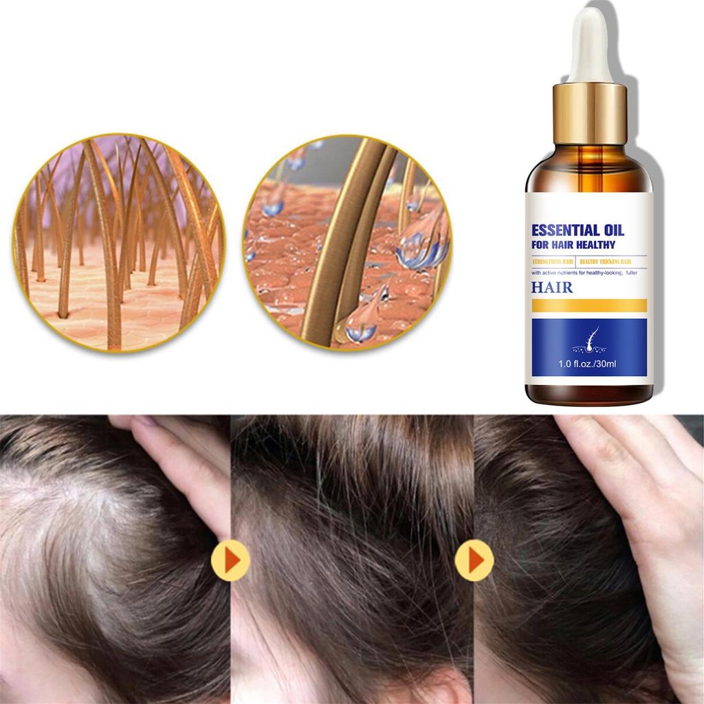 Масло для волос от выпадения волос Глубокое увлажнение для сухих поврежденных и жестких волос\30мл