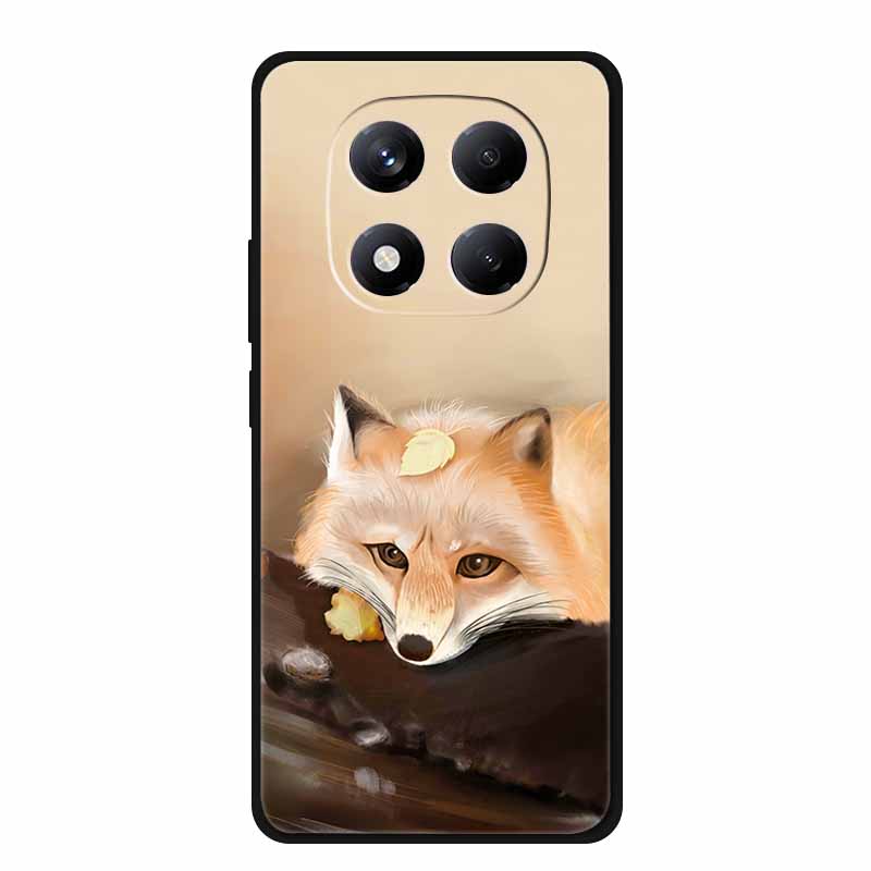 For Xiaomi Redmi Note 15 Pro / Note 15 Pro+ 5G Case Global Version 25060RABDG 2510ERA8BG Luxury Soft Silicone Back Cover Cases