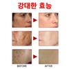 Spot Ampoule Whitening Отбеливающая эссенция Ампула Удаляет веснушки и пигментные пятна, улучшает пигментацию лица, 30 мл, 1 шт.
