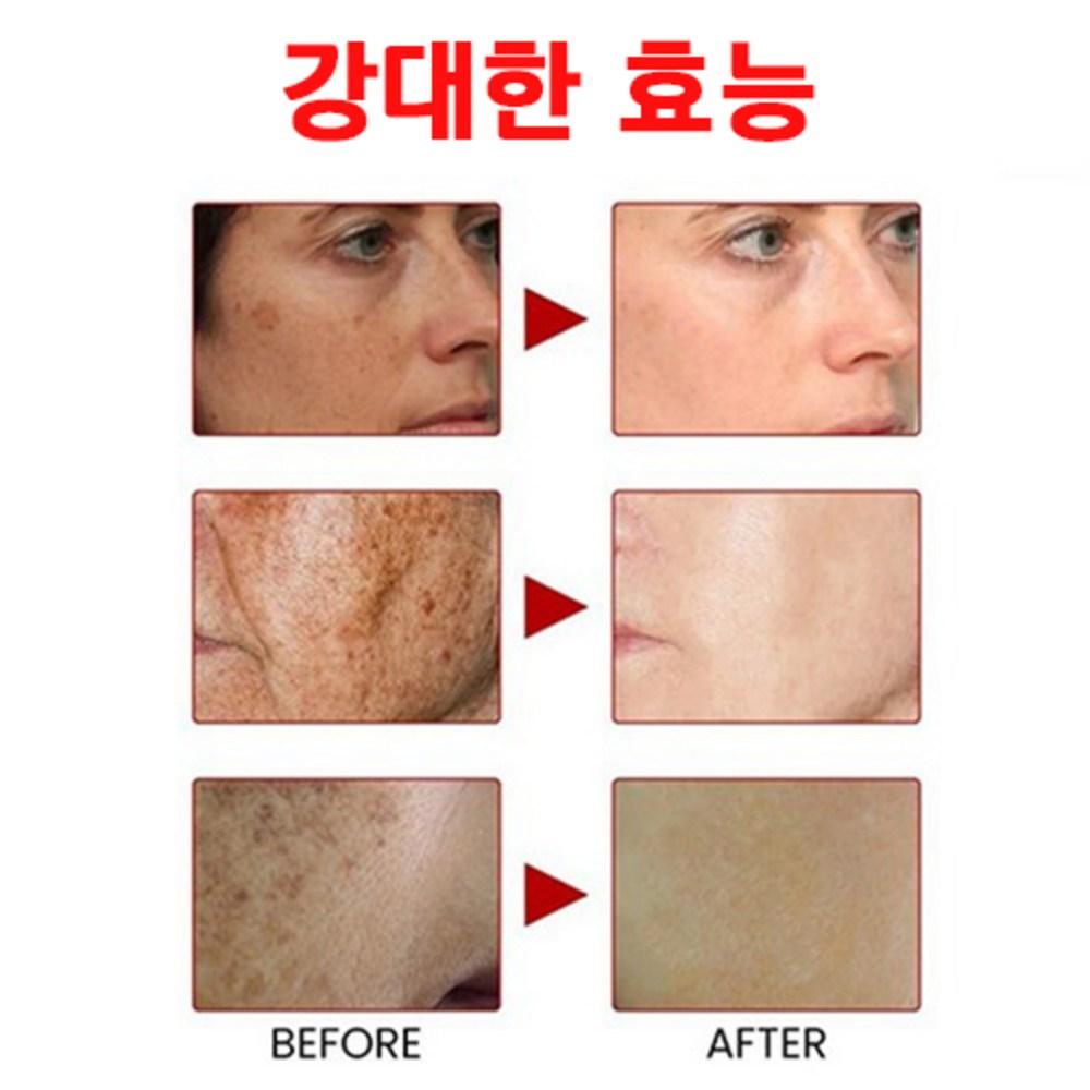 Spot Ampoule Whitening Отбеливающая эссенция Ампула Удаляет веснушки и пигментные пятна, улучшает пигментацию лица, 30 мл, 1 шт.