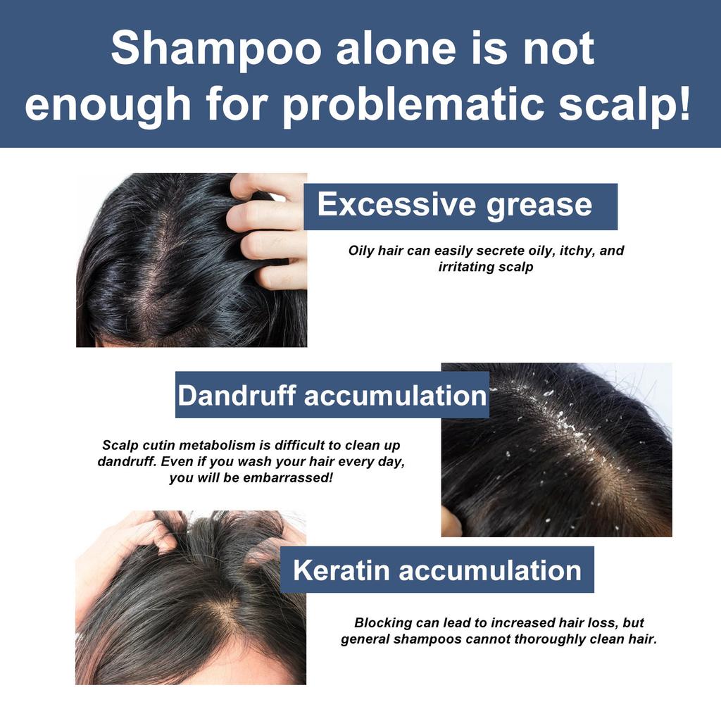 Скраб для кожи головы, Скраб для отшелушивания кожи головы, Кожа головы, Зуд кожи головы от перхоти, Питательный уход за волосами, Освежающий, Успокаивающий кожу головы, Наращивание, Очищающий