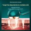 V.ONE ACE-II Устройство для лифтинга лица и глаз Beauty Device Штекер CN (адаптер в комплекте)
