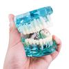 Dental Study Tooth Transparent Adult Pathological Teeth Model