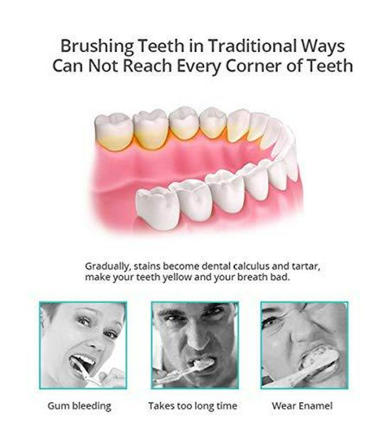 Электрическая зубная щетка U-образной формы с поворотом на 360° — дорожная щетка Hands-Free