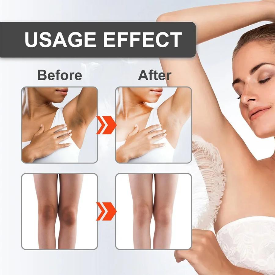 Отбеливающий отбеливающий крем для тела, осветляющий подмышки, локти, колени, удаление суставов, интимные части, темные пятна, отбеливающий крем с меланином, снег, 30 мл