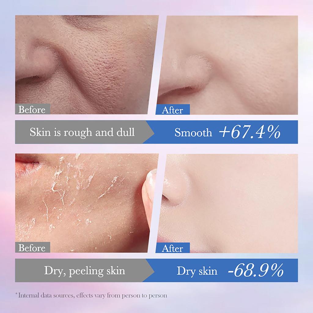 Women's Niacinamide Whitening  Removing Skin Repairing Moisturizing Toner Anti-Aging Nourishing Toner 100ml