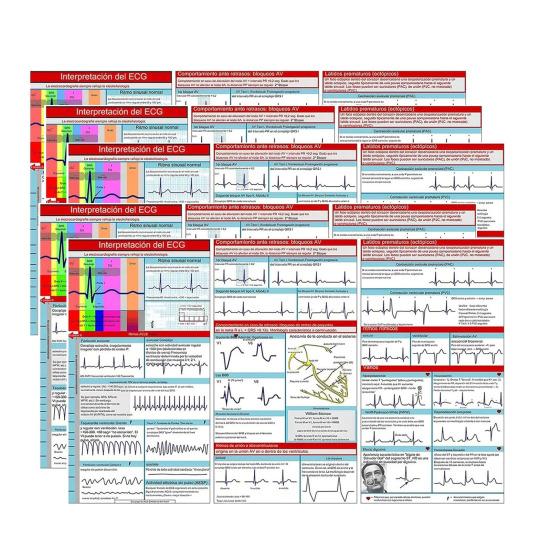 Карманный справочник ЭКГ Интерпретация ритма ЭКГ Двусторонняя карманная справочная карта Tri-Fold Study